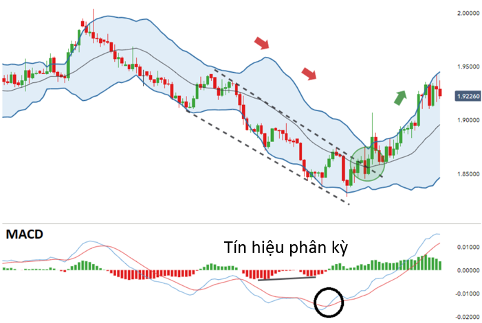 sử dụng bollinger band và macd